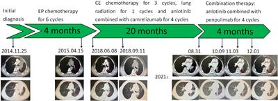 Successful Treatment of a Patient With Multiple-Line Relapsed Extensive-Stage Small-Cell Lung Cancer Receiving Penpulimab Combined With Anlotinib: A Case Report